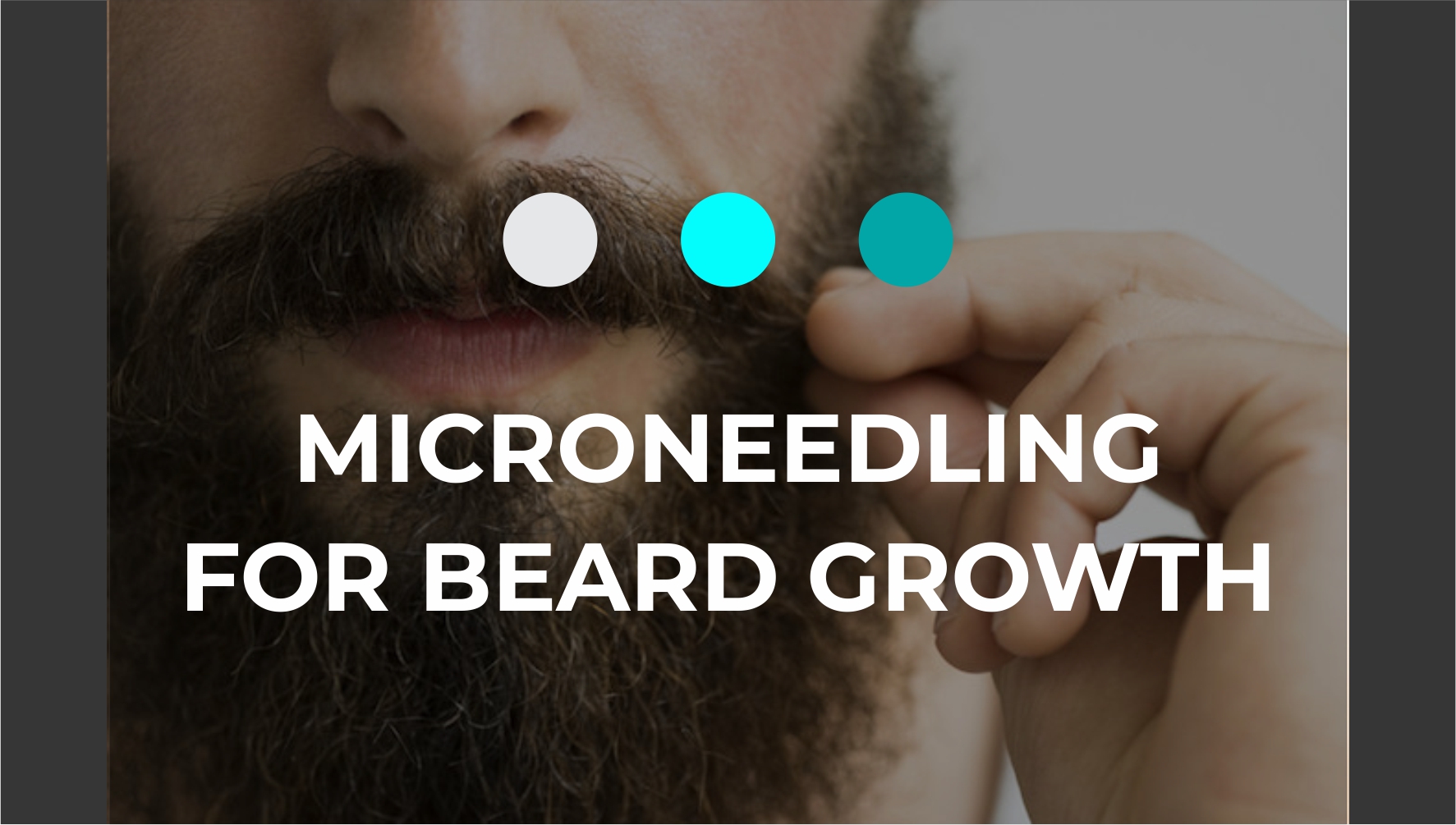 Microneedling for Beard Growth