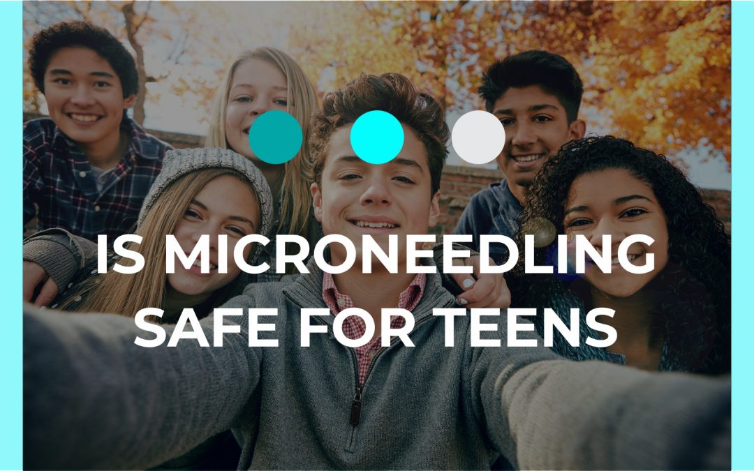 Is DermaRolling Safe for Teens?